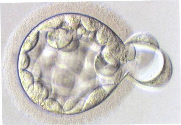 Thực hiện IVF: Trường hợp nào cần hỗ trợ phôi thoát màng?