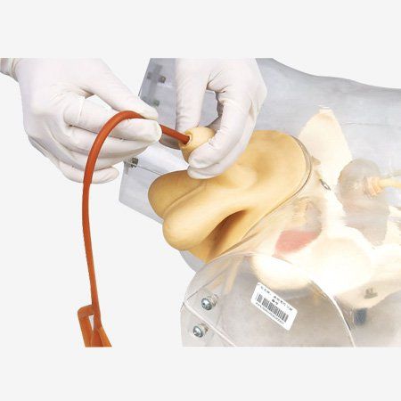 Chẩn đoán giãn đài bể thận bằng siêu âm thực hiện thế nào?