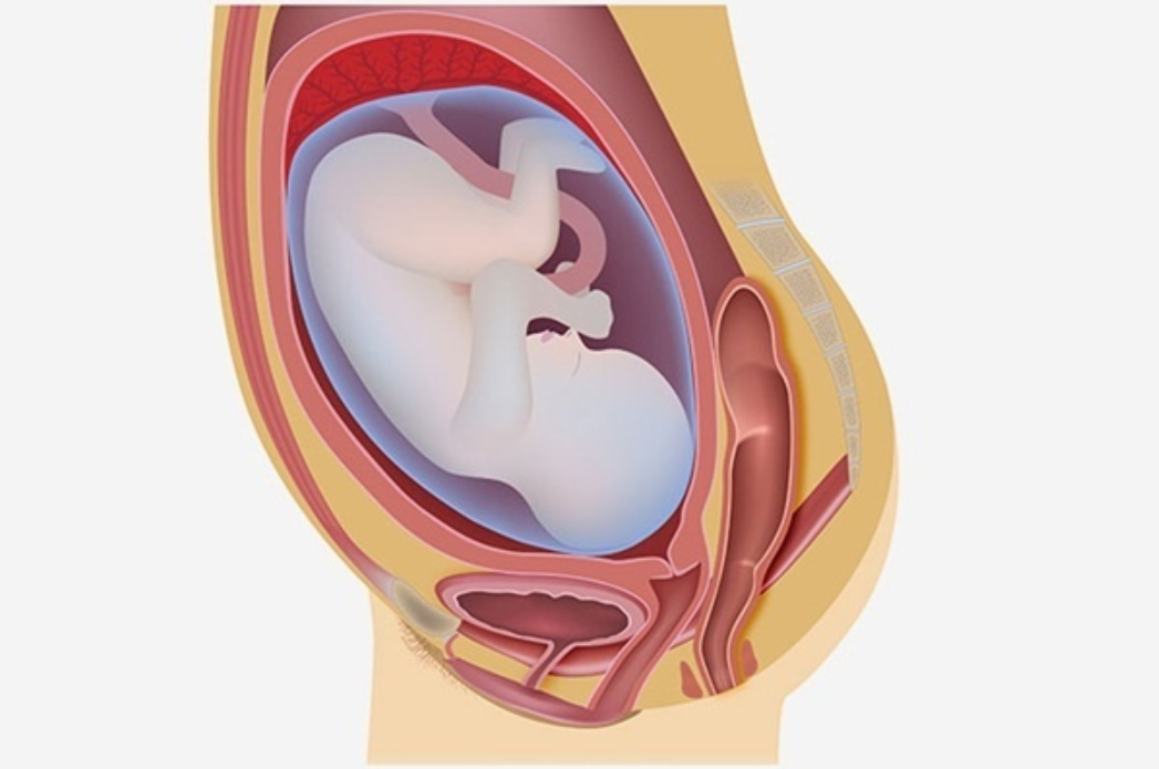 Nguyên nhân và triệu chứng viêm màng ối khi mang thai
