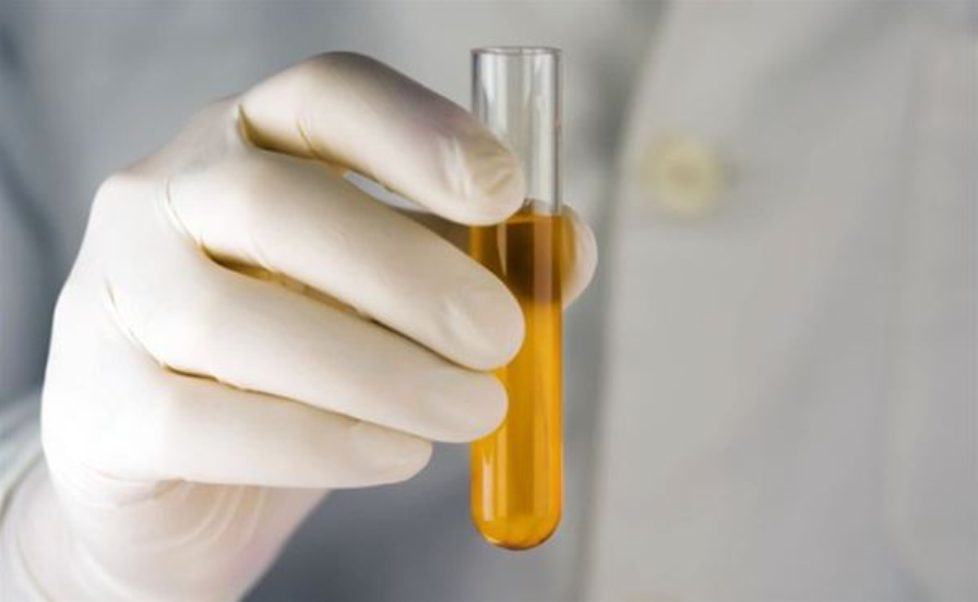 Cách tính hệ số thanh thải creatinin