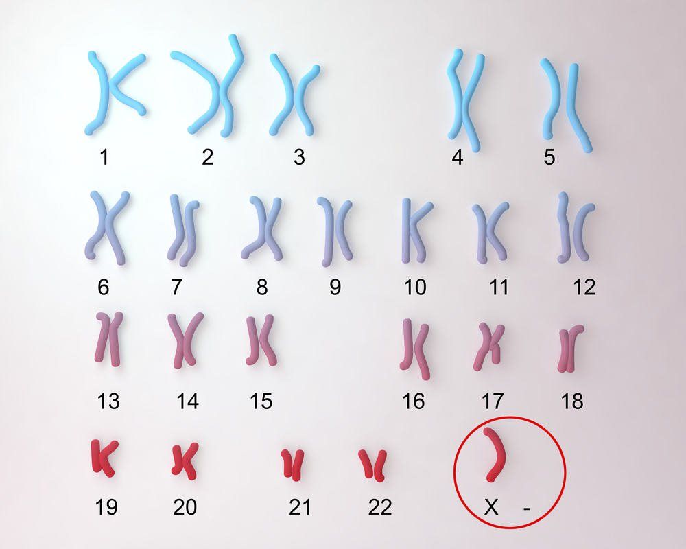3 xét nghiệm nhiễm sắc thể trong thai kỳ