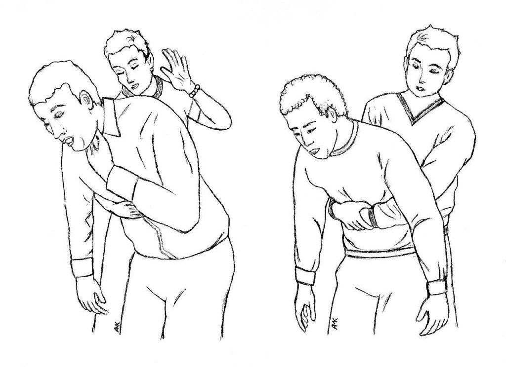 Tư thế người bệnh đứng hơi ngả đầu về phía trước