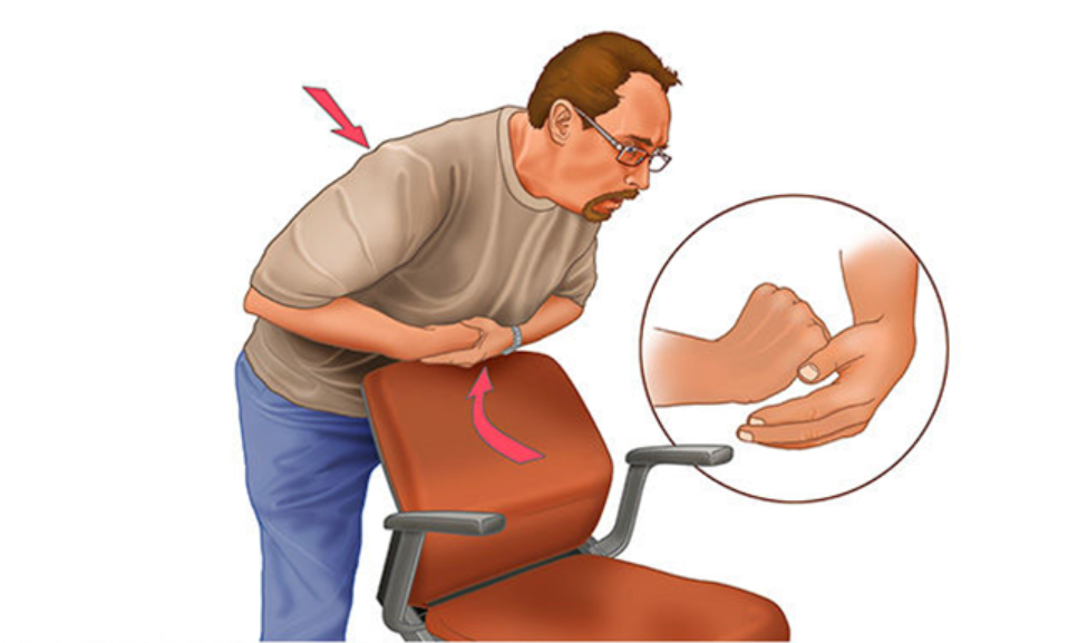 Tự thực hiện thủ thuật Heimlich