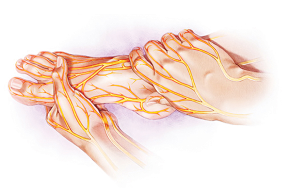 Dấu hiệu đau dây thần kinh ngoại biên