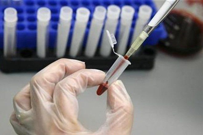 Xét nghiệm NAT phát hiện sớm viêm gan B - C