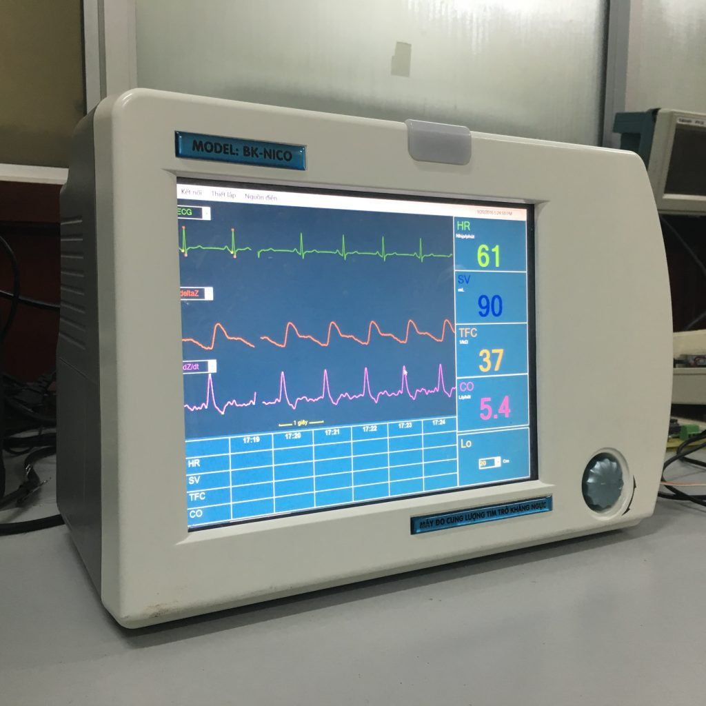 Đặt stent trong nhồi máu cơ tim