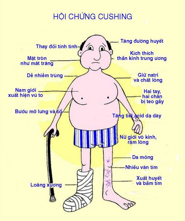 Ý nghĩa chỉ số xét nghiệm ACTH đánh giá hội chứng Cushing và bệnh Addison