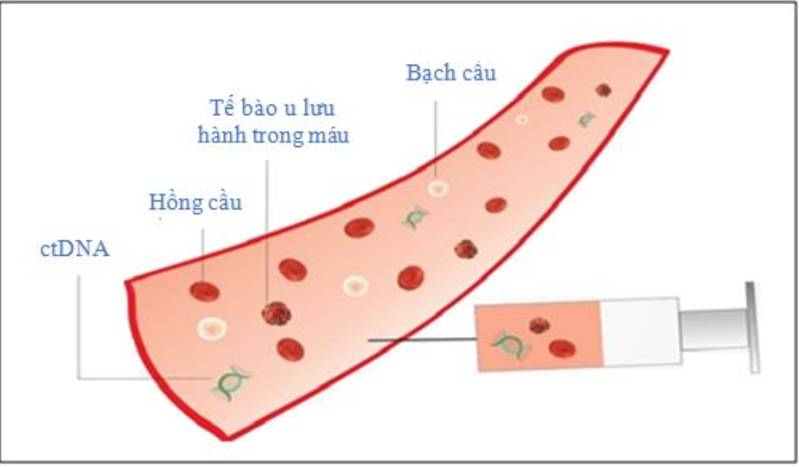 Tìm hiểu về phương pháp sinh thiết lỏng ctDNA chẩn đoán ung thư