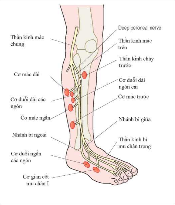 Tổn thương thần kinh mác