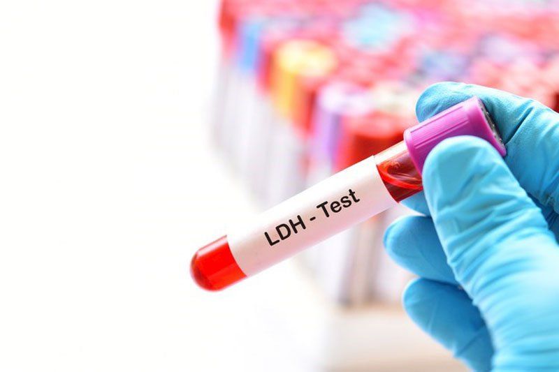 Xét nghiệm axit lactic dehydrogenase đo nồng độ của LHD trong máu