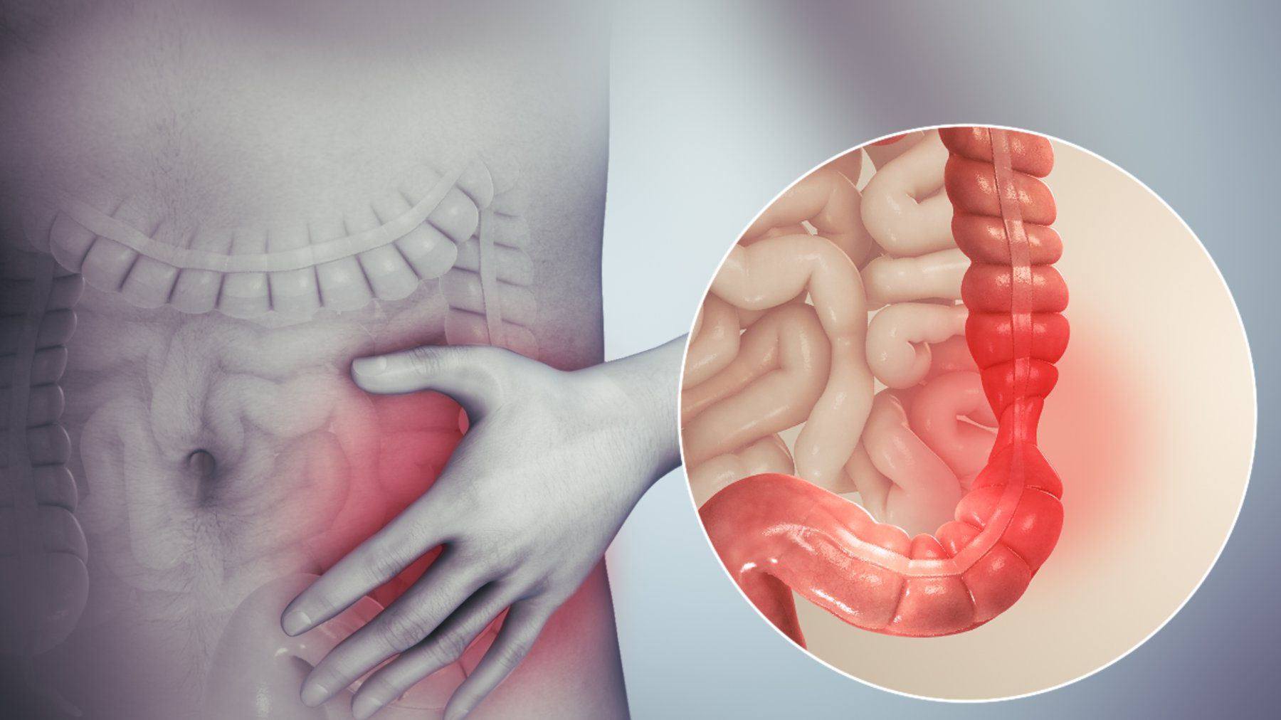 Thắt ống dẫn trứng là gì?