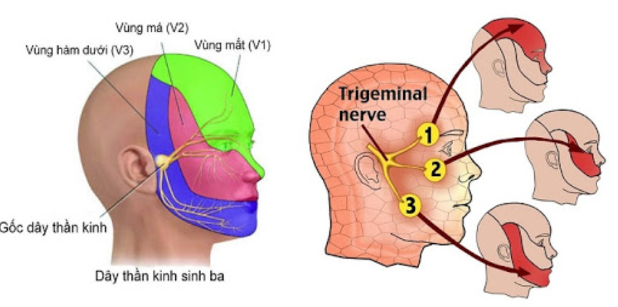 Vì sao bạn đau dây thần kinh số 5?