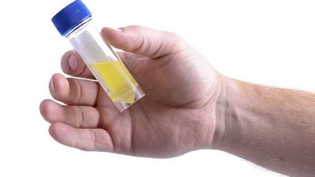 Vì sao cần lấy nước tiểu giữa dòng để xét nghiệm?