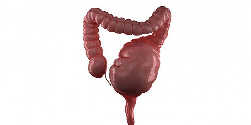 Phẫu thuật nội soi điều trị Megacolon (phẫu thuật Soave đường hậu môn một thì)