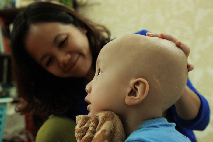 Có vắc-xin quai bị riêng không hay tất cả là vắc-xin phối hợp?