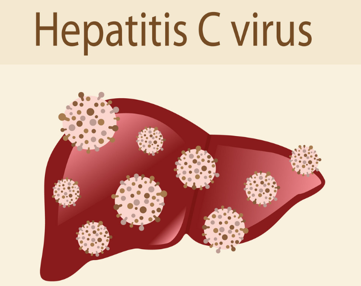 Xét nghiệm anti HCV là xét nghiệm gì?