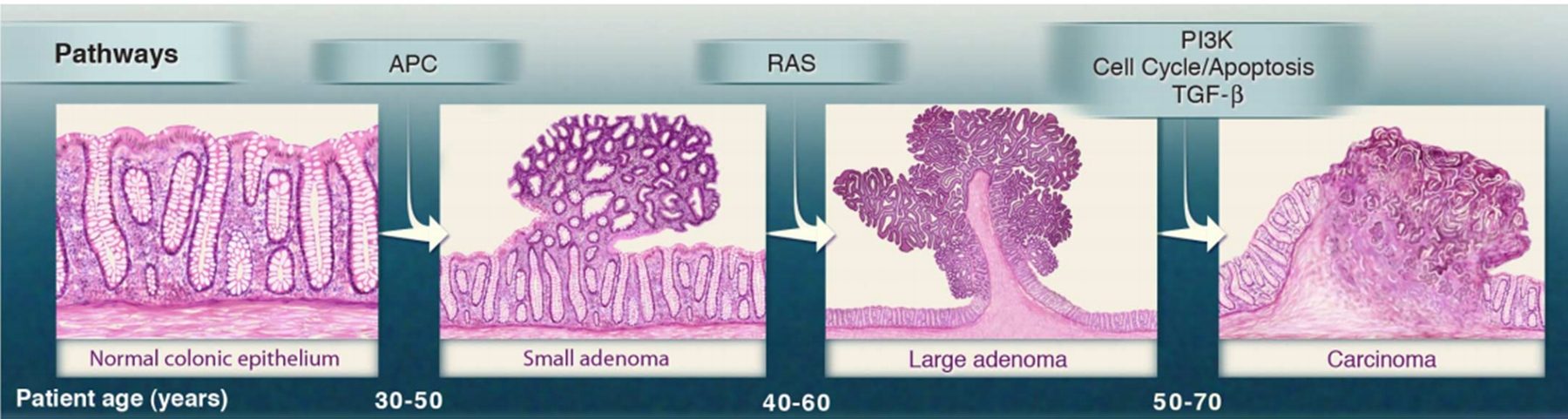 Tiến bộ trong xét nghiệm gen đánh giá nguy cơ ung thư di truyền
