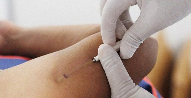 Vô kinh sau khi cấy que tránh thai có đáng ngại không?