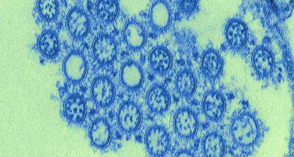 Xét nghiệm influenza virus A B test nhanh chẩn đoán bệnh cúm