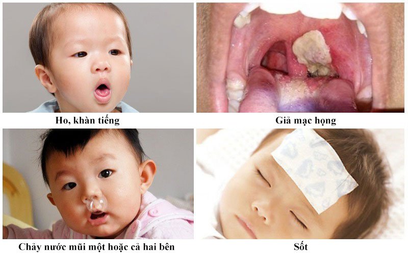 Vi khuẩn nào gây bệnh bạch hầu?