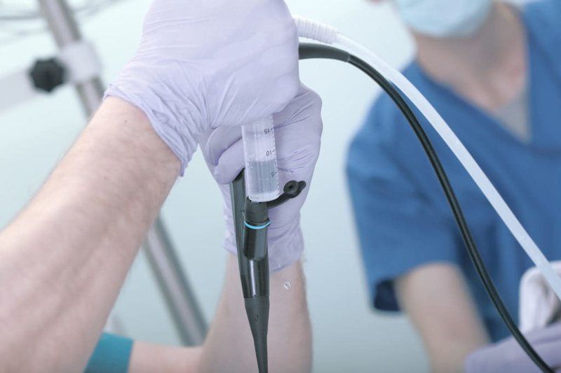 Thế nào là chụp niệu đạo bàng quang ngược dòng?
