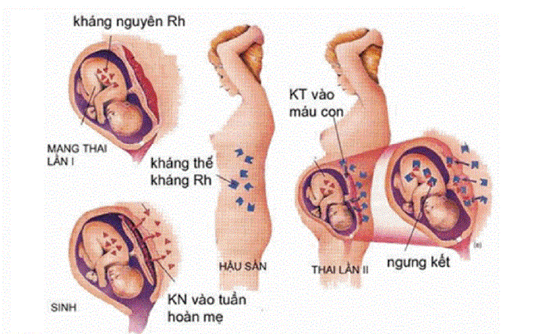 Những Điều Cần Biết Về Nhóm Máu M