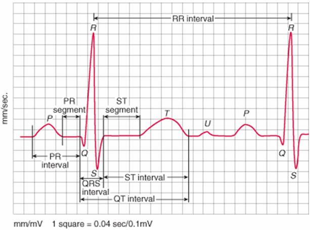 Sóng P là gì? Các dạng sóng P của điện tâm đồ