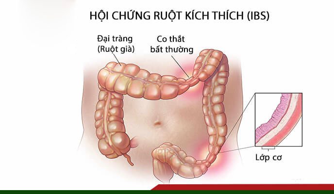 Có thuốc nào điều trị tiêu chảy đau rát hậu môn không?
