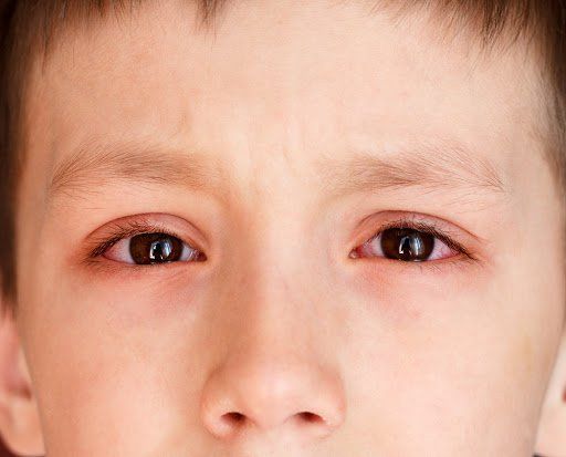 16 lý do mắt bạn có thể bị mờ đột ngột