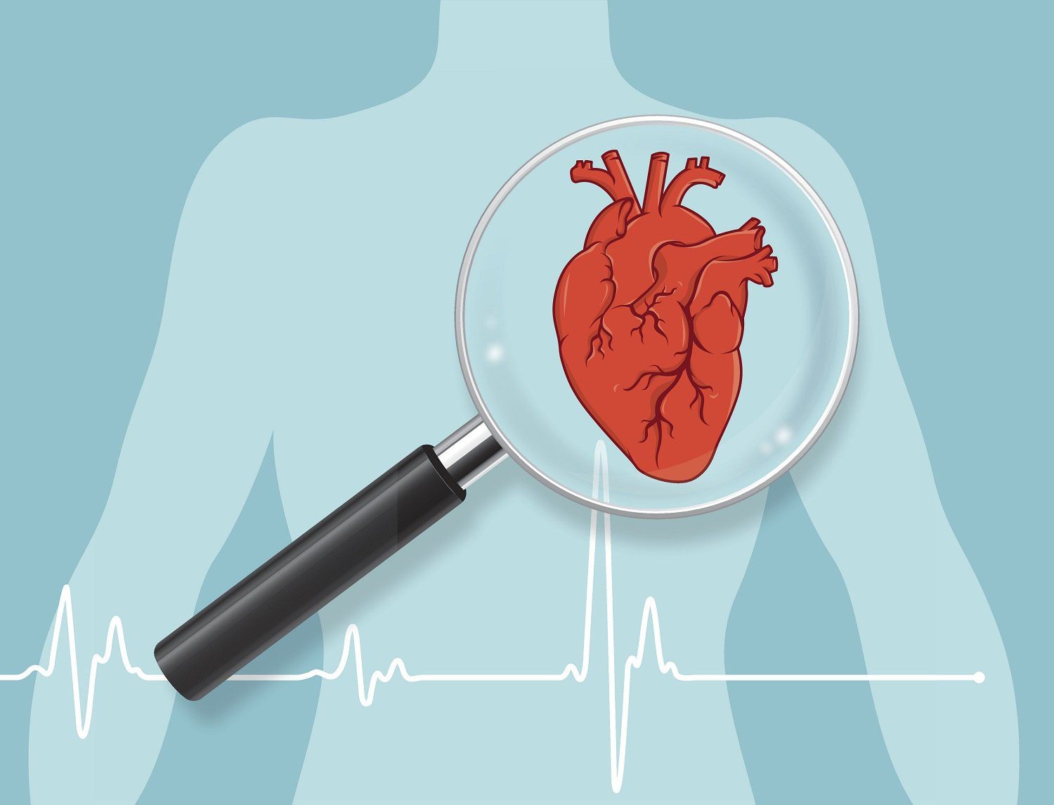 Gây mê hồi sức trong bệnh cơ tim thiếu máu và tái tưới máu mạch vành - Phần 2
