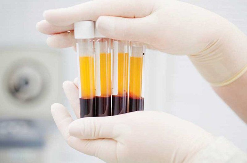Những khía cạnh của sự sử dụng (General aspects of utilization) trong chẩn đoán huyết thanh
