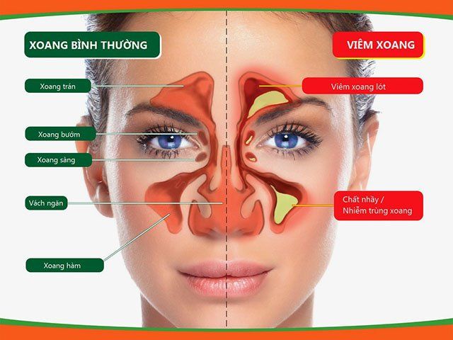 Vị trí, chức năng xoang bướm
