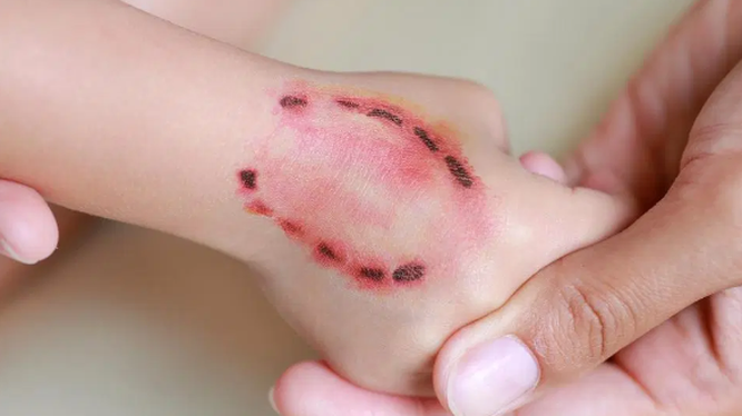 Vắc-xin phòng dại có tác dụng bao lâu?