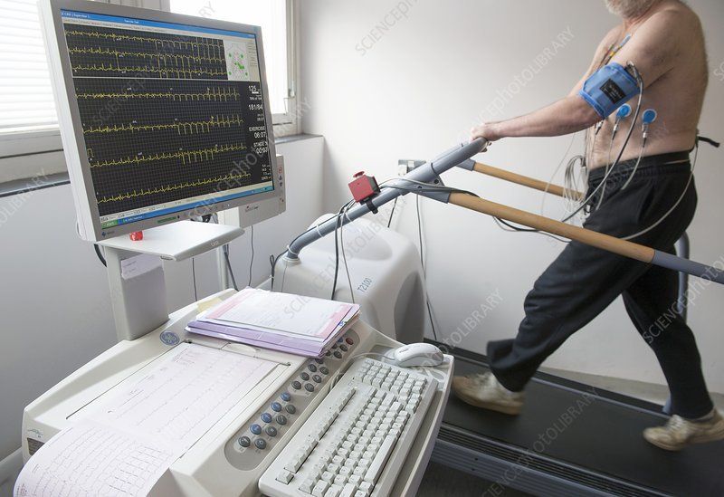 Tìm hiểu về siêu âm tim stress