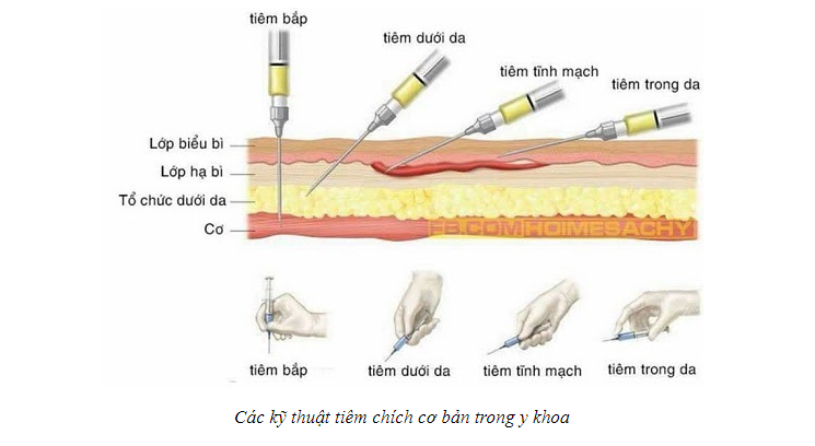 Các kỹ thuật tiêm chích cơ bản trong y khoa