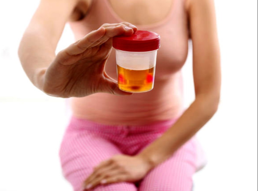 Chẩn đoán giãn đài bể thận bằng siêu âm thực hiện thế nào?