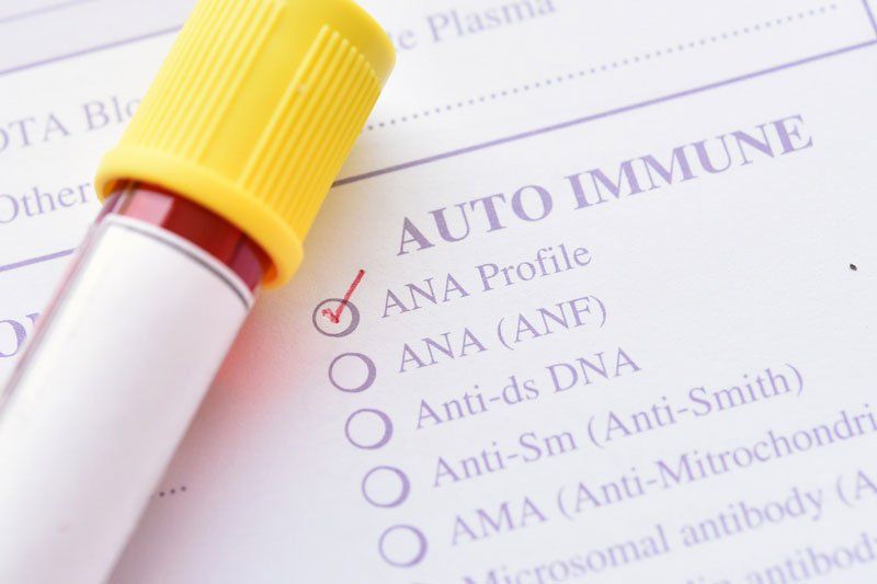 Ý nghĩa của các kháng thể trong bệnh Lupus ban đỏ hệ thống