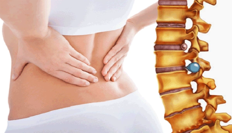 Đau dây thần kinh liên sườn có nguy hiểm không?