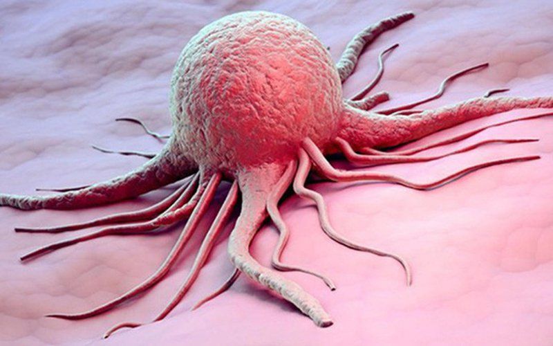 Phẫu thuật nội soi cắt 3/4 dạ dày