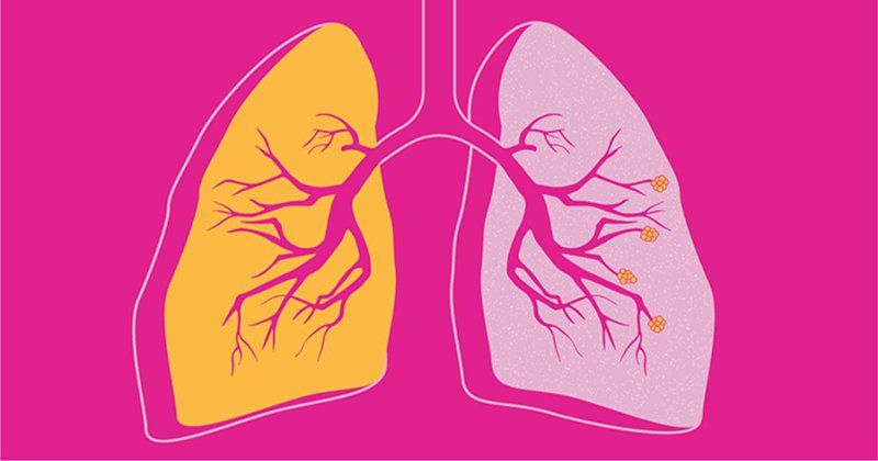 Chụp số hóa xóa nền và nút động mạch cầm máu các tạng