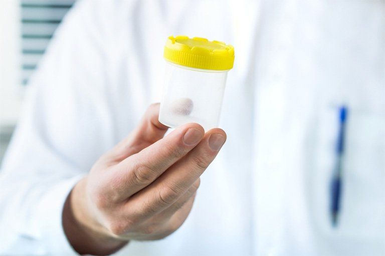 Phân tích số lượng tinh trùng dựa vào kết quả xét nghiệm tinh dịch đồ