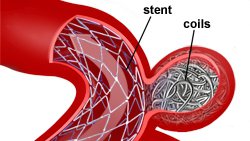 Chảy máu dưới nhện Phần 3: Đánh giá ban đầu