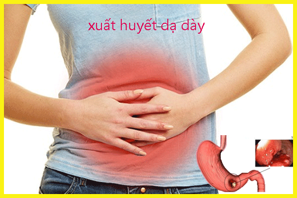 Thuốc Ibuprofen dạng viên: Công dụng, chỉ định và lưu ý khi dùng