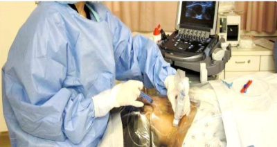 Chụp số hóa xóa nền và điều trị phình động mạch não bằng thay đổi dòng chảy