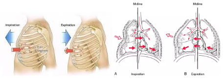 Mảng sườn di động do chấn thương ngực