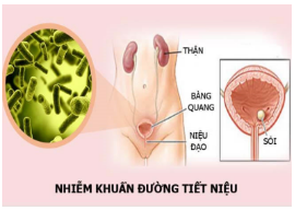 Cách lấy bệnh phẩm nước tiểu và 3 phương pháp lấy mẫu nước tiểu cấy