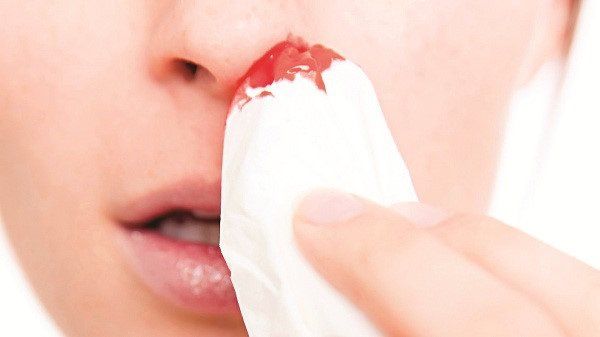 Khi nào cần phẫu thuật nội soi mũi xoang?