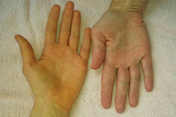 Thuốc tatanol 500mg: Công dụng và liều dùng