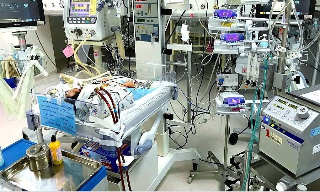 Tìm hiểu về kỹ thuật ECMO (Tim - phổi nhân tạo)