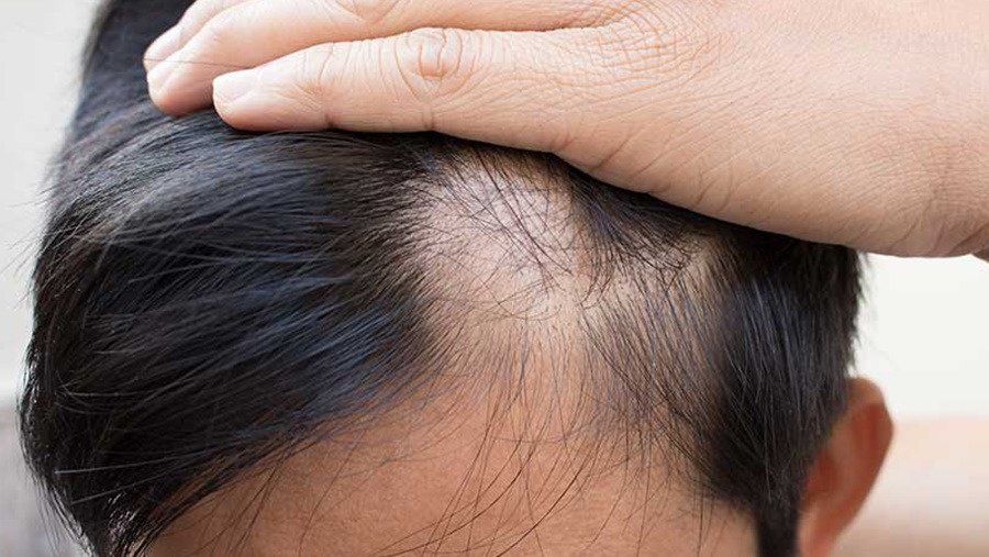 Chiều cao ảnh hưởng đến sức khỏe của bạn như thế nào?